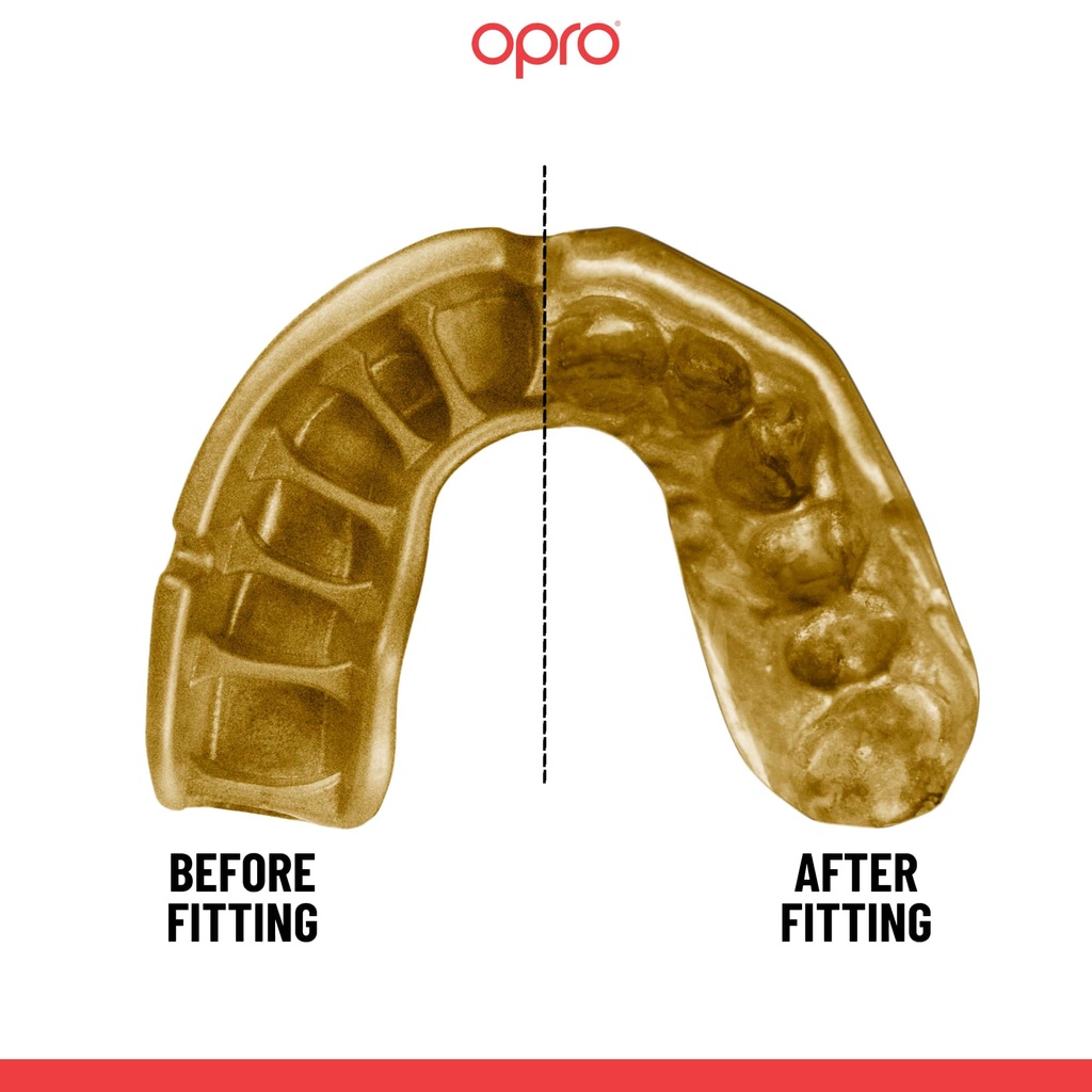 OPRO Gold Self-Fit Mouthguard