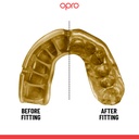 OPRO Self-Fit GEN5 Gold Grillz Mouthguard